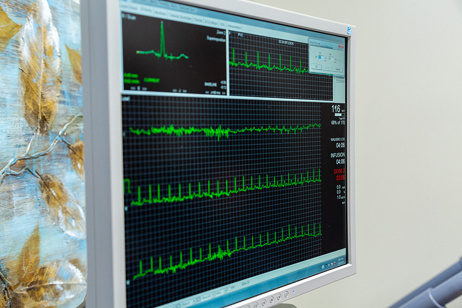 A close up of a monitor displaying heart rhythm lines